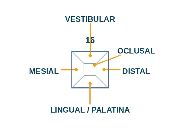 Caras del diente: vestibular, lingual, mesial, distal y oclusal