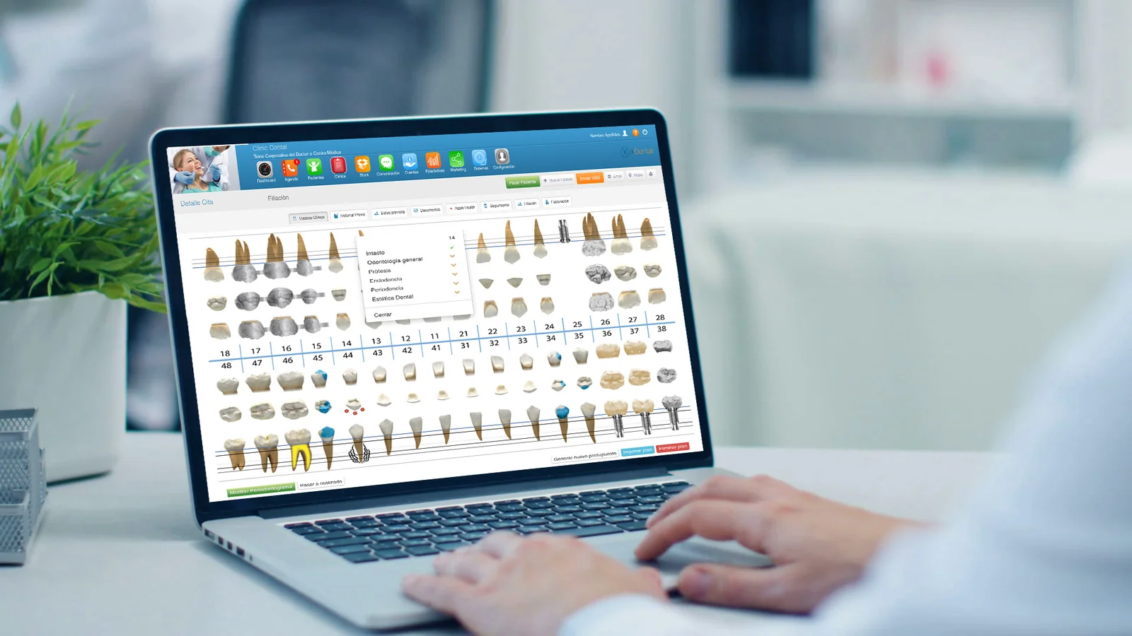 Periodontograma digital de XDentalCloud con la exploración completa