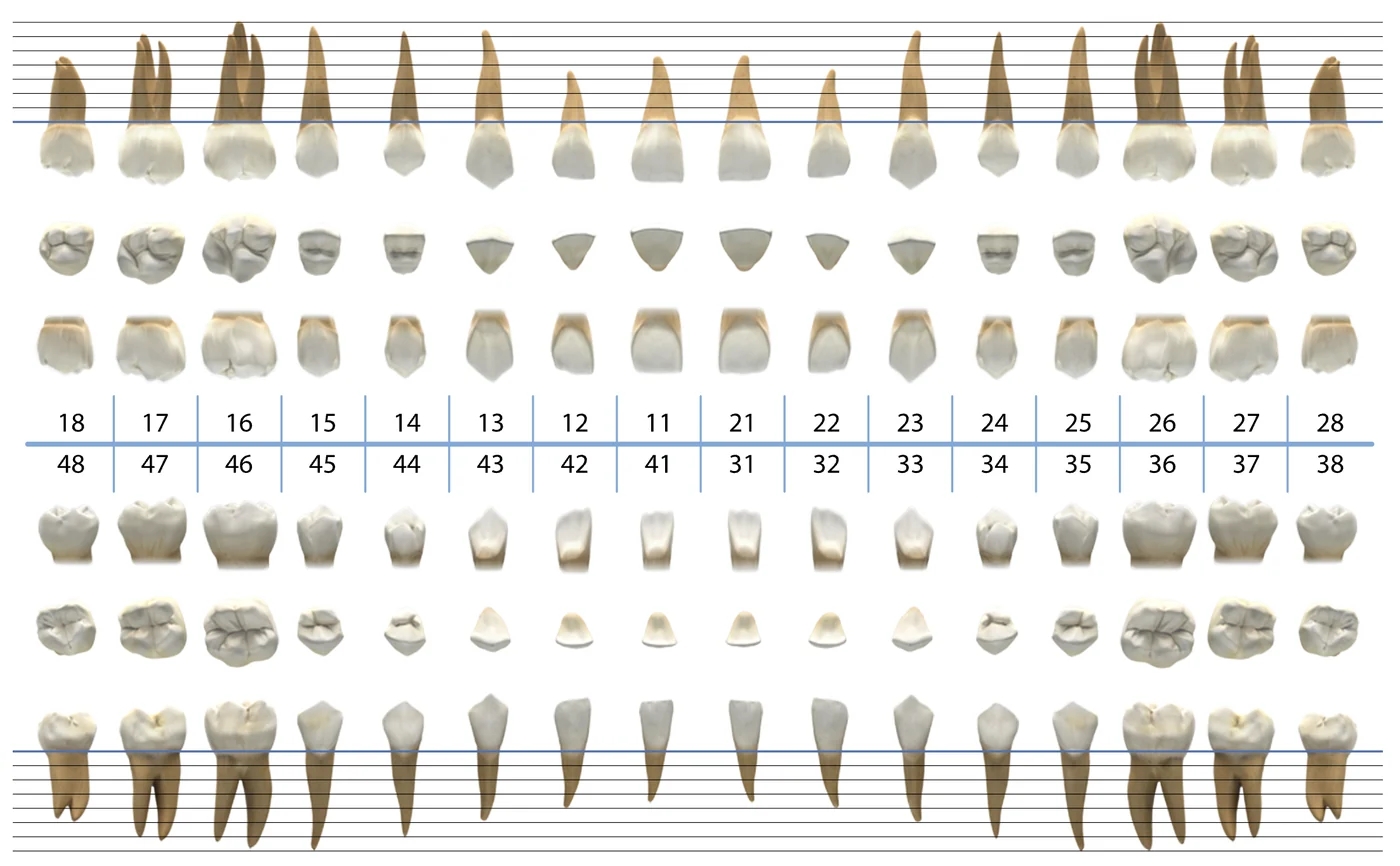 Periodontograma de XDentalCloud.com: atlas dental con escala de sondaje periodontal superpuesta