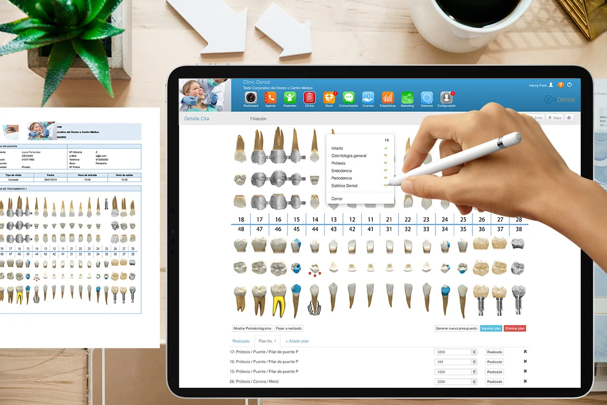 Odontograma de XDentalCloud en un iPad con lápiz táctil junto al plan de tratamiento impreso